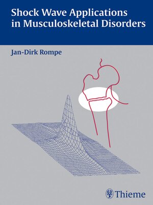 cover image of Shock Wave Applications in Musculoskeletal Disorders